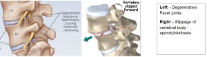 Spine Anatomy 2