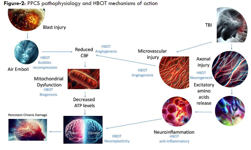 The Role of Bubbles in Brain Injury