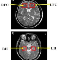GTH Brain